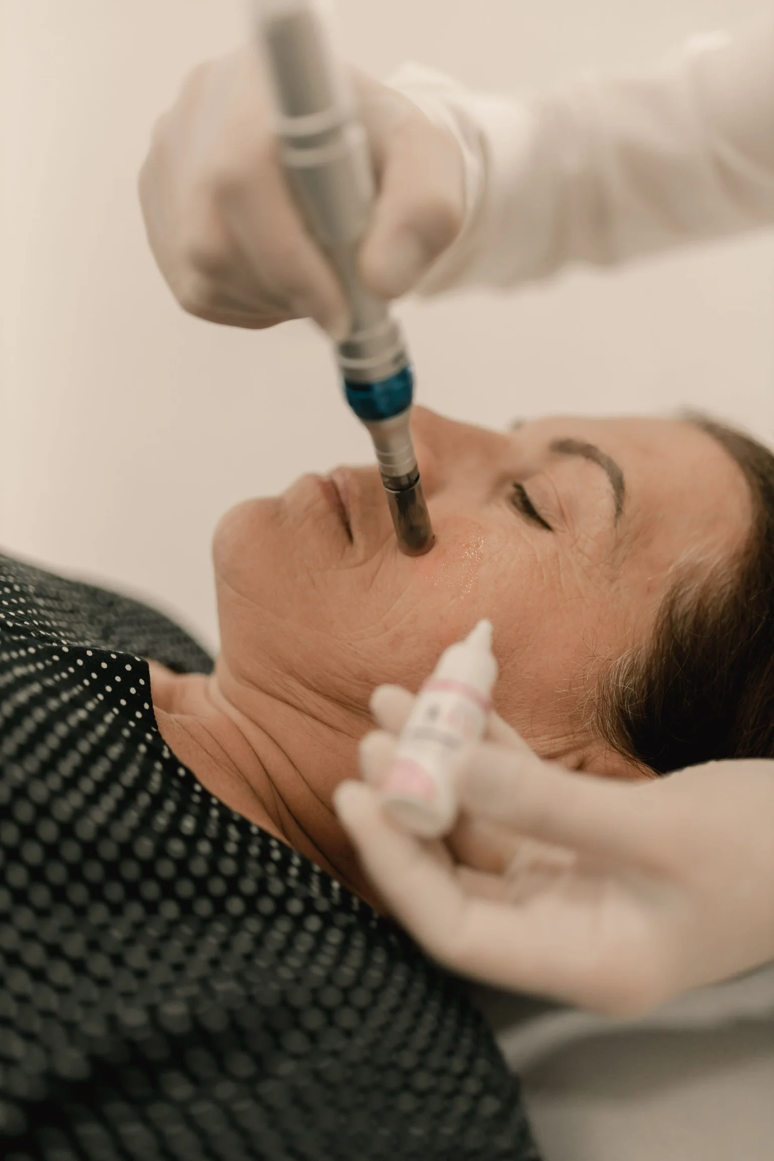 Microagulhamento Facial com Drug Delivery