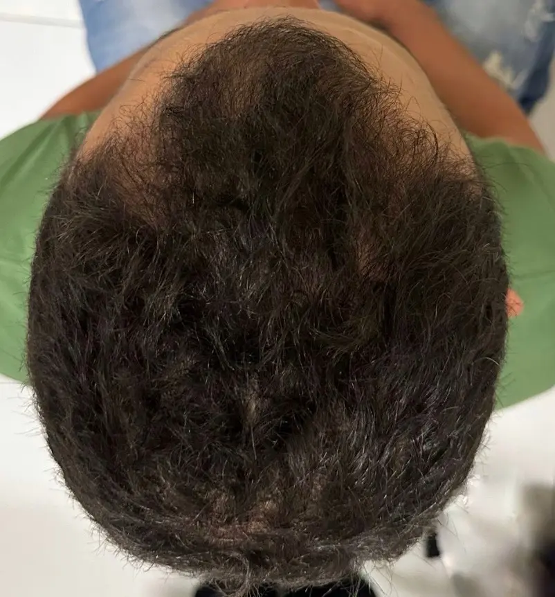 Paciente 2 - Antes