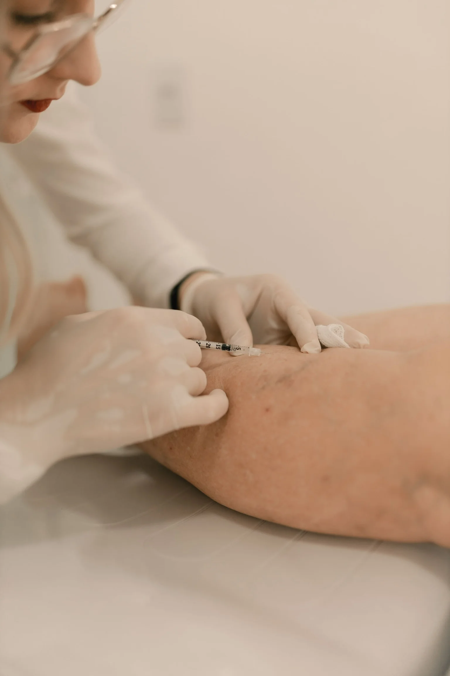 Escleroterapia — Secagem de Vasinhos